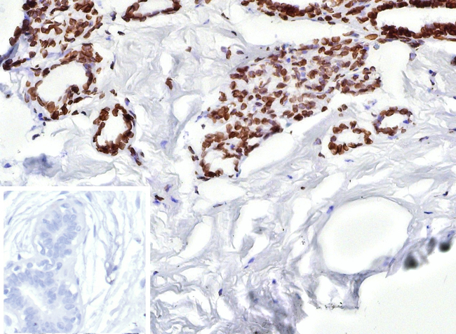 ER-beta (Estrogen Receptor beta-2) Antibody in Immunohistochemistry (Paraffin) (IHC (P))