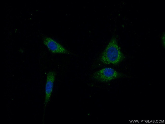 OTUD5 Antibody in Immunocytochemistry (ICC/IF)