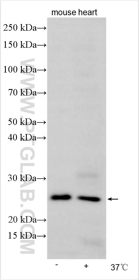 PLA2G4A Antibody in Western Blot (WB)