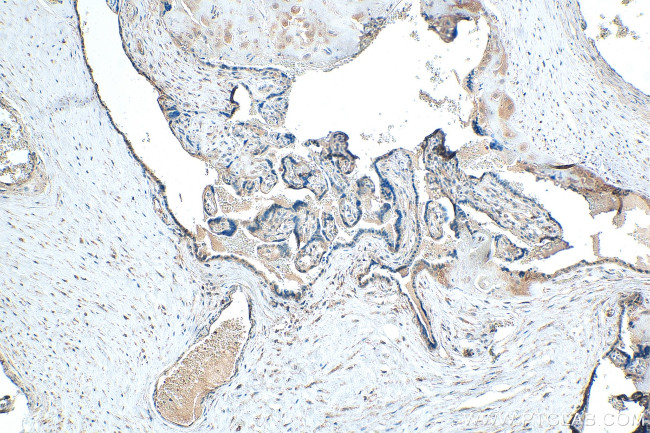LHFPL1 Antibody in Immunohistochemistry (Paraffin) (IHC (P))