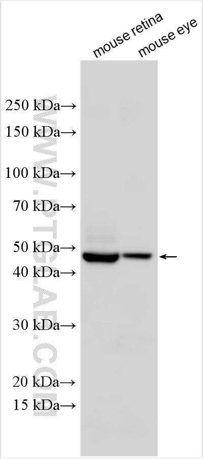 Thyroid Hormone Receptor beta Antibody in Western Blot (WB)