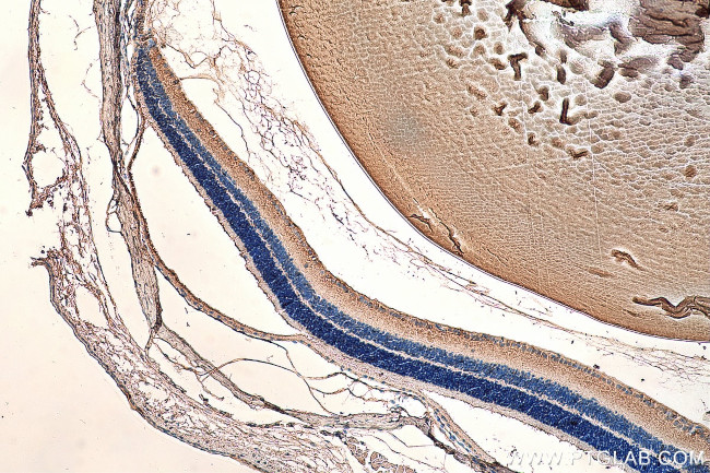 CRYBB3 Antibody in Immunohistochemistry (Paraffin) (IHC (P))