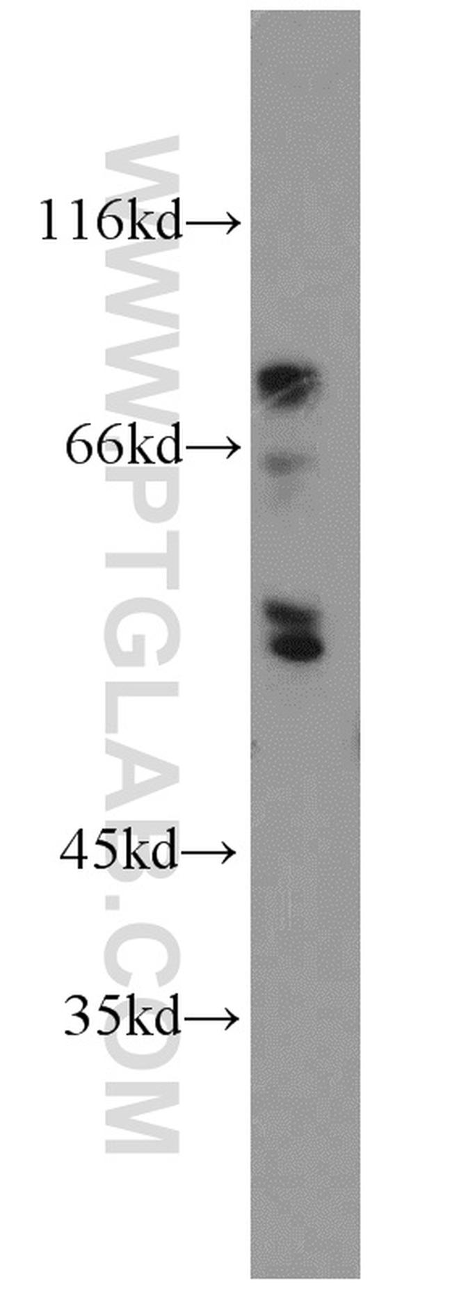 ENTPD8 Antibody in Western Blot (WB)