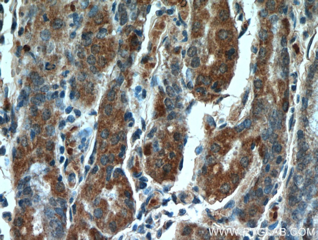 CLEC18A Antibody in Immunohistochemistry (Paraffin) (IHC (P))