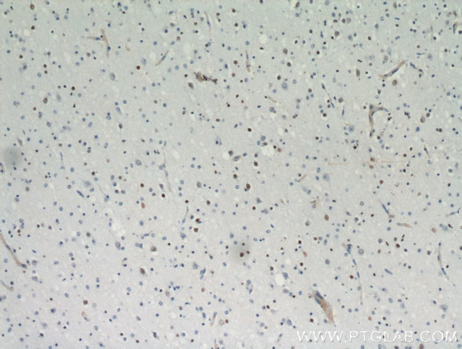 ZNF488 Antibody in Immunohistochemistry (Paraffin) (IHC (P))
