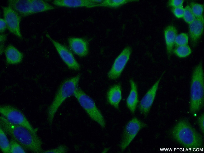 KIAA0319L Antibody in Immunocytochemistry (ICC/IF)