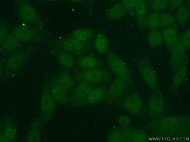 KLF5 Antibody in Immunocytochemistry (ICC/IF)