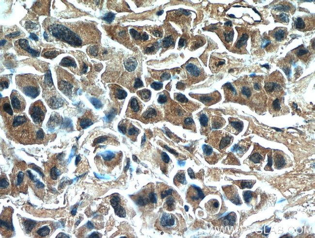 RNF170 Antibody in Immunohistochemistry (Paraffin) (IHC (P))