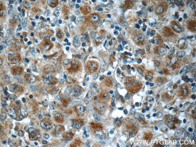 RNF213 Antibody in Immunohistochemistry (Paraffin) (IHC (P))
