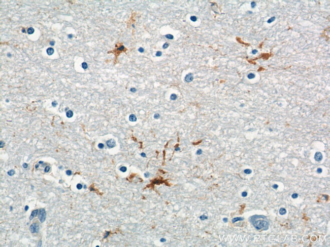 MAS1L Antibody in Immunohistochemistry (Paraffin) (IHC (P))