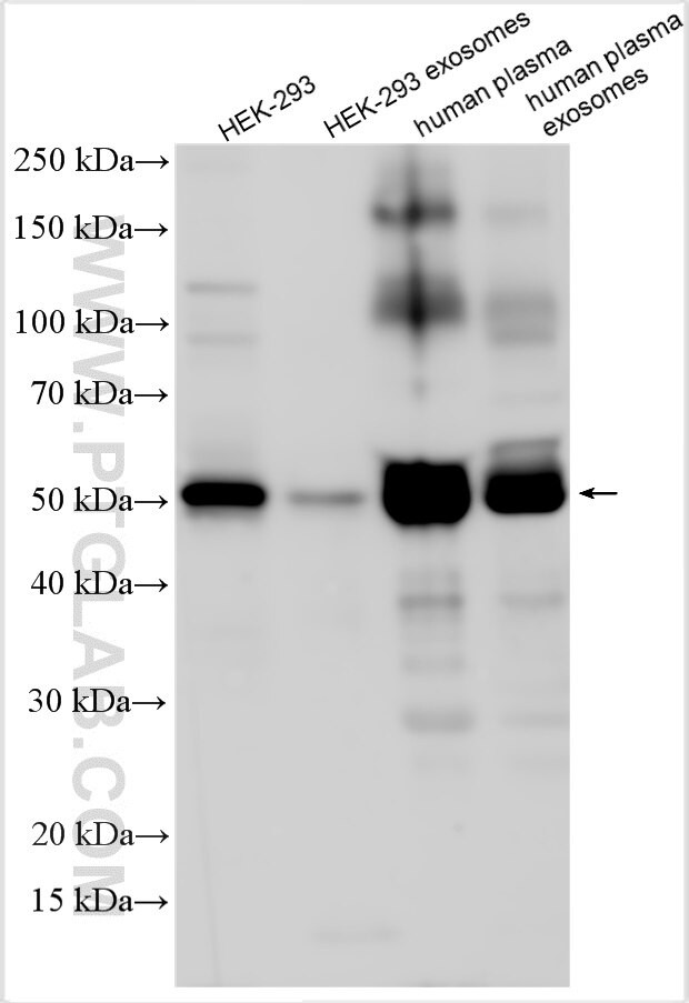 ARRDC1 Antibody in Western Blot (WB)