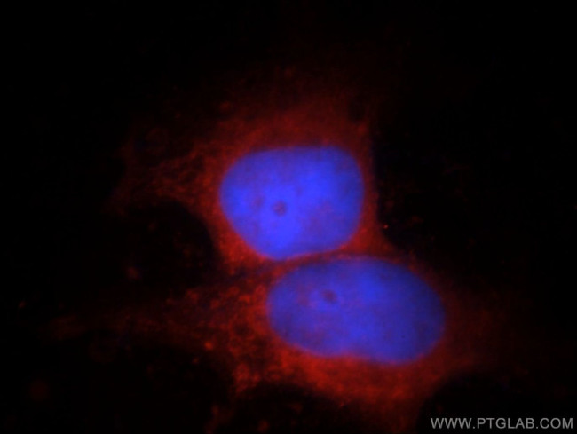 FSD1L Antibody in Immunocytochemistry (ICC/IF)