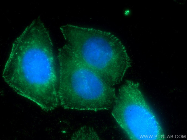 FAM78A Antibody in Immunocytochemistry (ICC/IF)