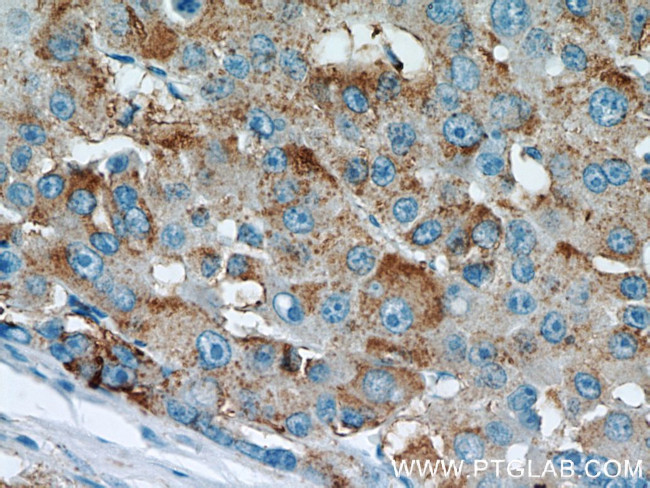 Willin Antibody in Immunohistochemistry (Paraffin) (IHC (P))