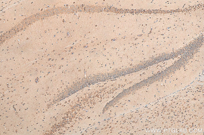 TMX3 Antibody in Immunohistochemistry (Paraffin) (IHC (P))