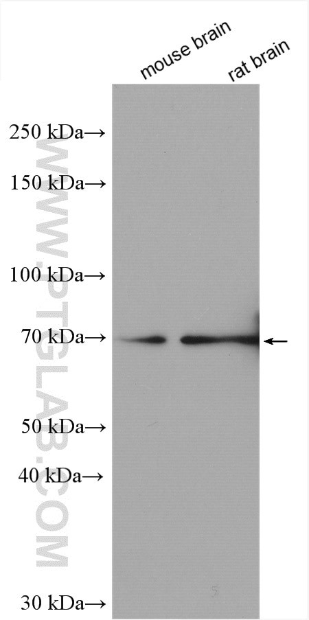 MED26 Antibody in Western Blot (WB)