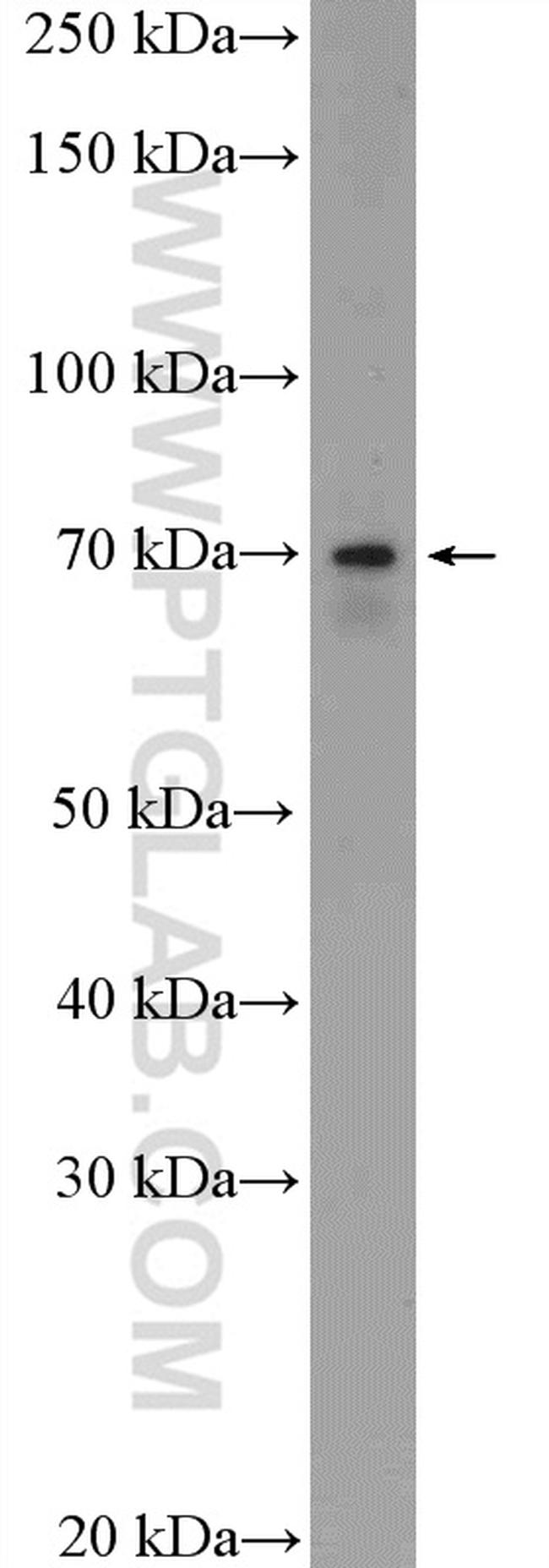 ESRP1 Antibody in Western Blot (WB)