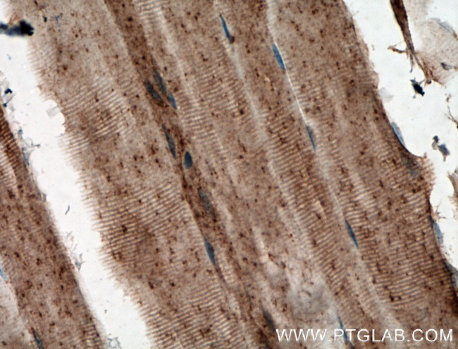 GLUT4 Antibody in Immunohistochemistry (Paraffin) (IHC (P))