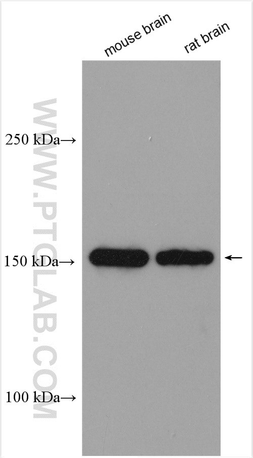 FLT3 Antibody in Western Blot (WB)