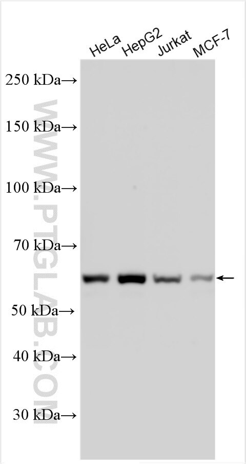 THUMPD2 Antibody in Western Blot (WB)