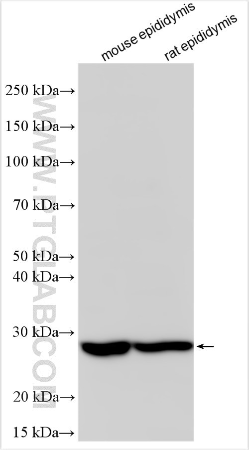 LHFPL5 Antibody in Western Blot (WB)