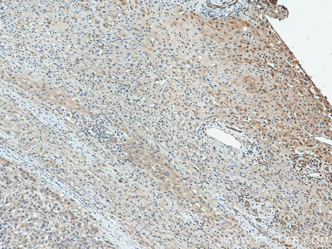 PNO1 Antibody in Immunohistochemistry (Paraffin) (IHC (P))
