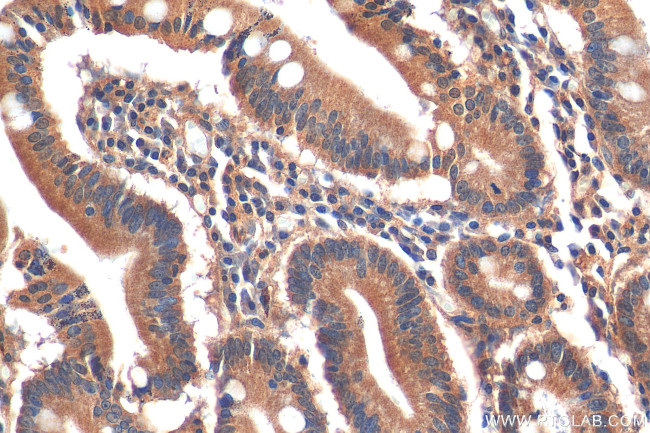 C19orf45 Antibody in Immunohistochemistry (Paraffin) (IHC (P))