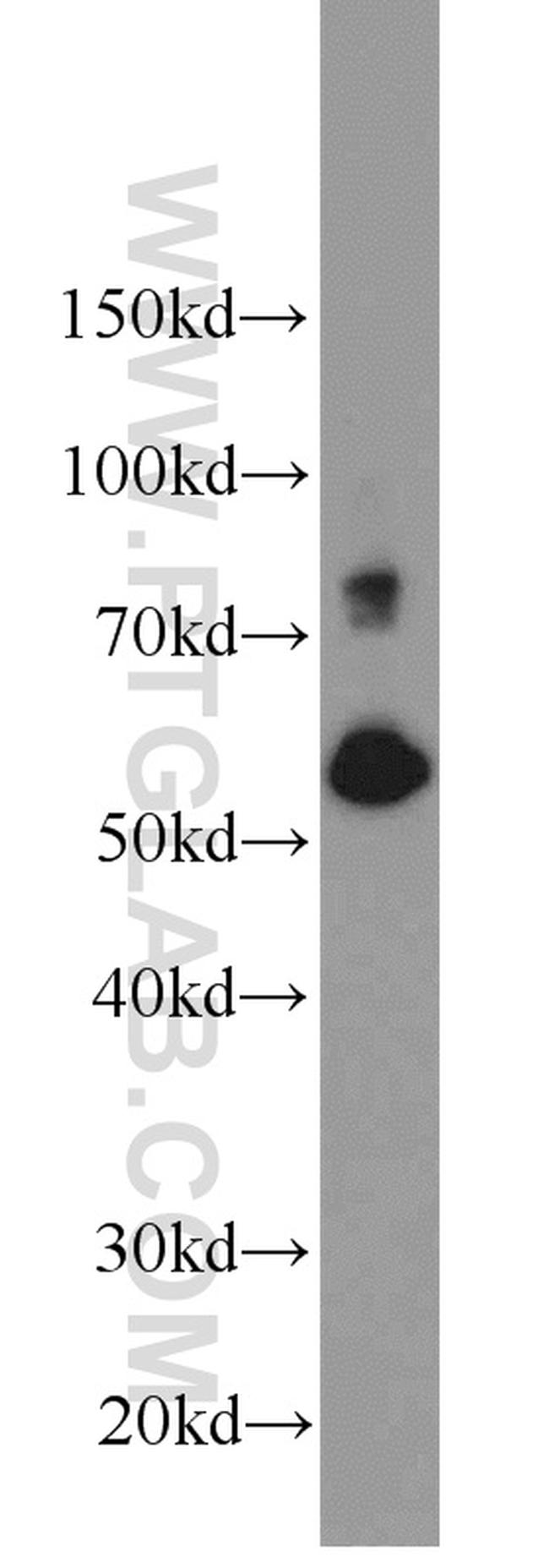 SIM2 Antibody in Western Blot (WB)