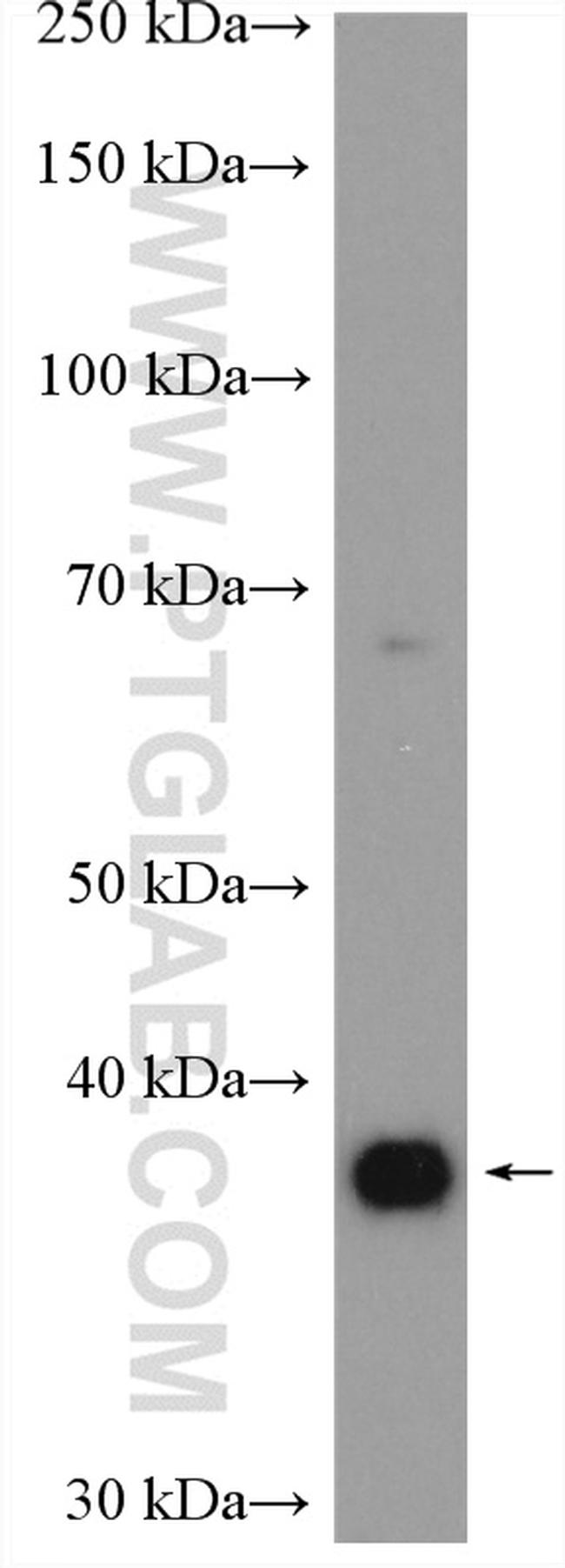 ADORA2B Antibody in Western Blot (WB)