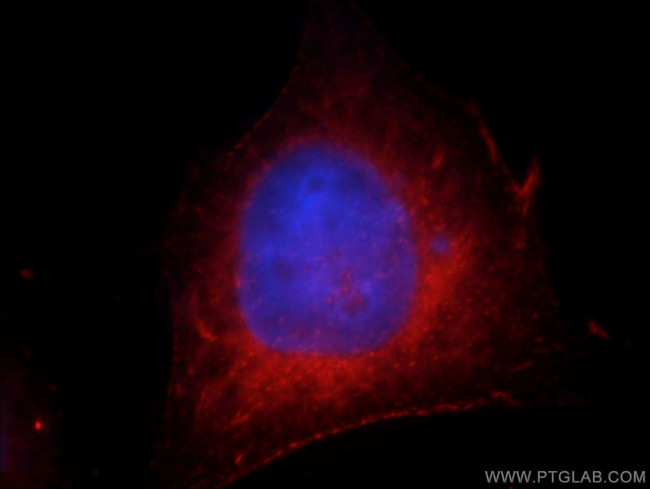 FAM119A Antibody in Immunocytochemistry (ICC/IF)
