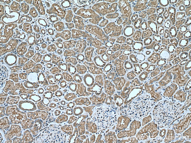 CCDC50 Antibody in Immunohistochemistry (Paraffin) (IHC (P))