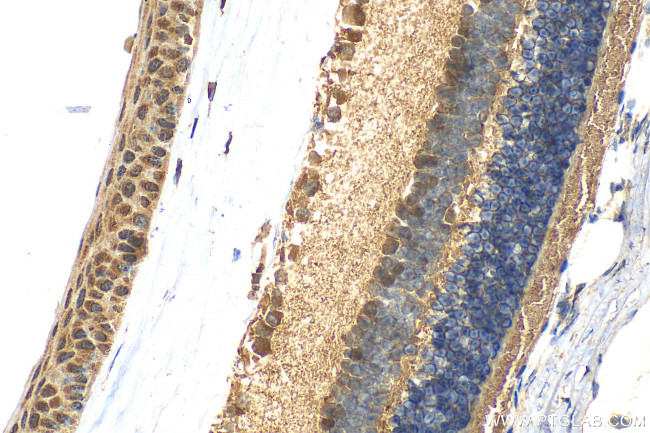 PDZD7 Antibody in Immunohistochemistry (Paraffin) (IHC (P))