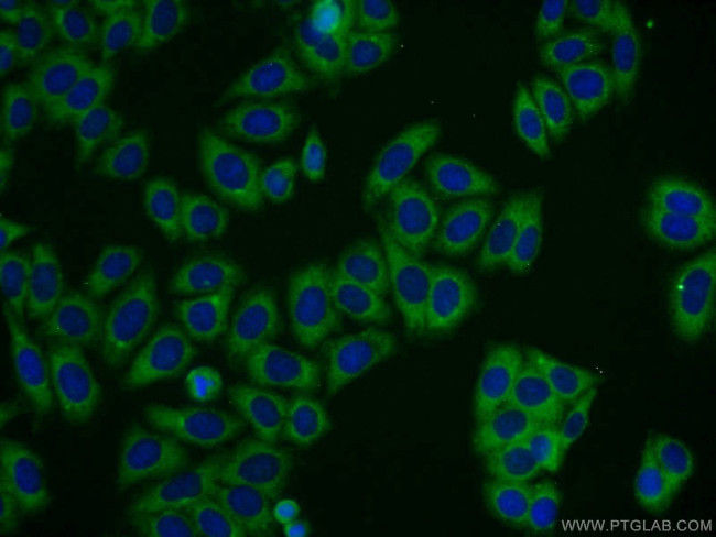 TBC1D19 Antibody in Immunocytochemistry (ICC/IF)