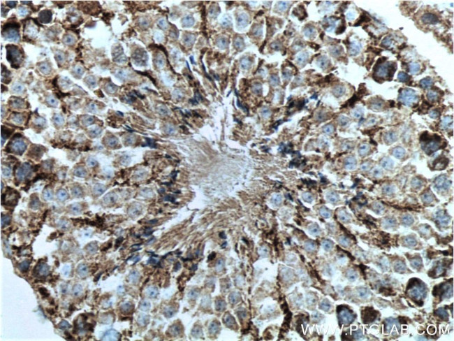 CHCHD4 Antibody in Immunohistochemistry (Paraffin) (IHC (P))