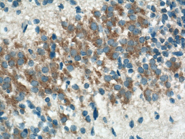 TMCC1 Antibody in Immunohistochemistry (Paraffin) (IHC (P))
