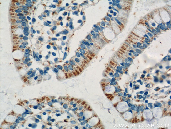 ANKRD13D Antibody in Immunohistochemistry (Paraffin) (IHC (P))