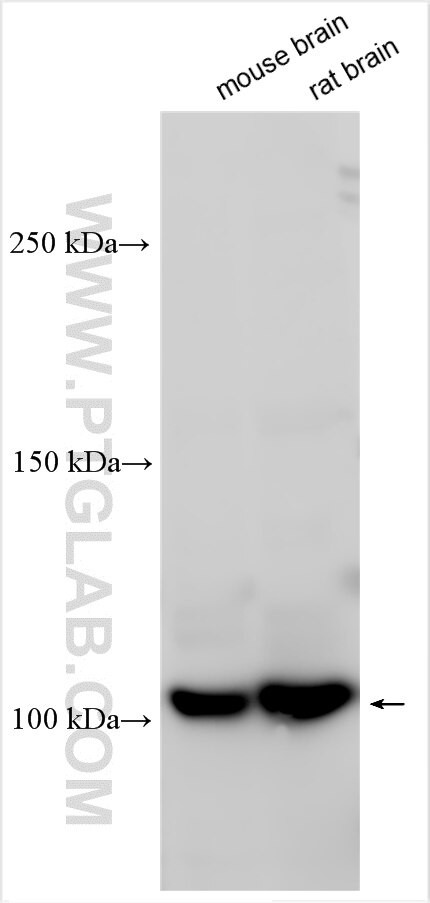 FEZ2 Antibody in Western Blot (WB)