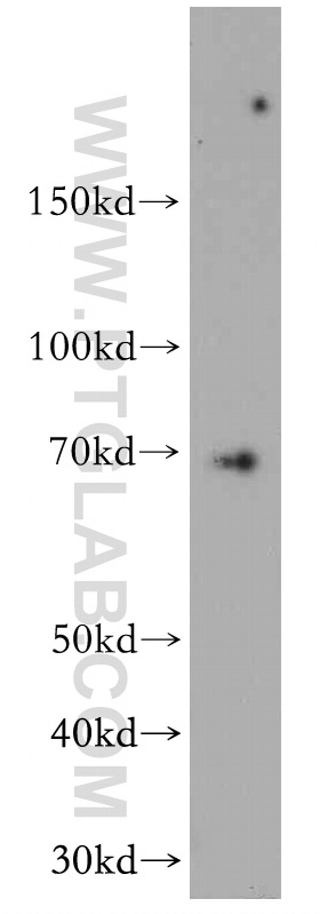 CCDC9 Antibody in Western Blot (WB)