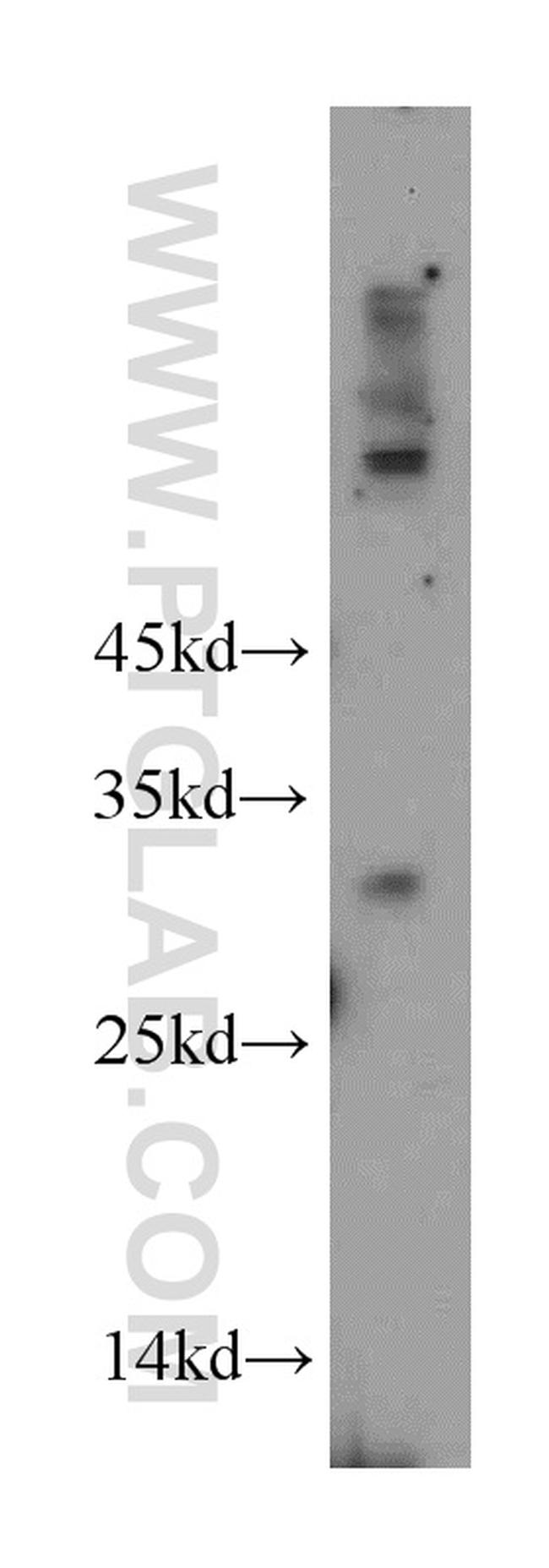 KCTD14 Antibody in Western Blot (WB)