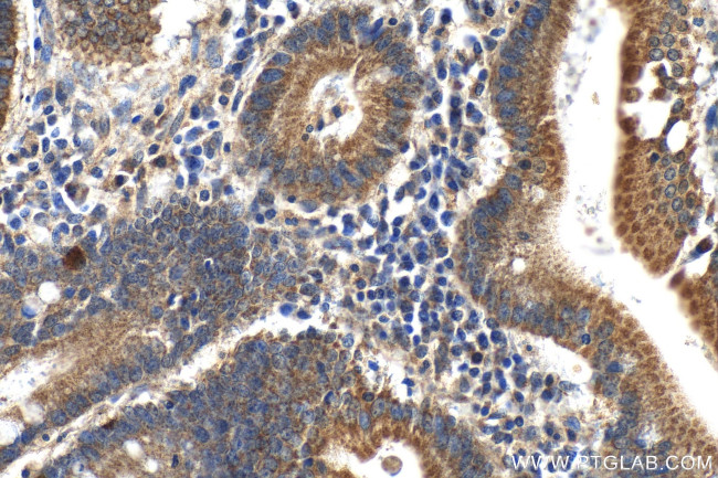 SLC44A5 Antibody in Immunohistochemistry (Paraffin) (IHC (P))