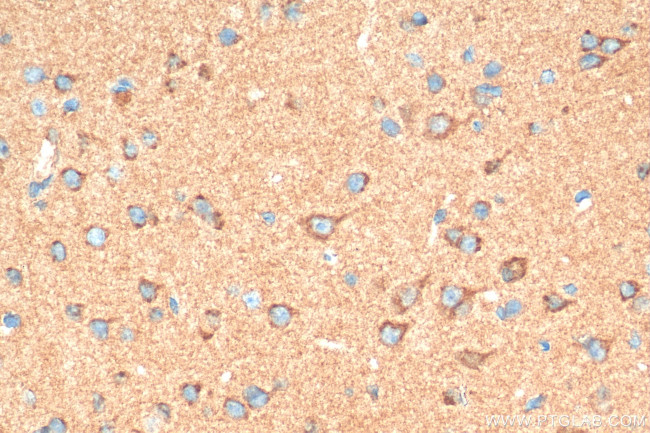 SLITRK1 Antibody in Immunohistochemistry (Paraffin) (IHC (P))