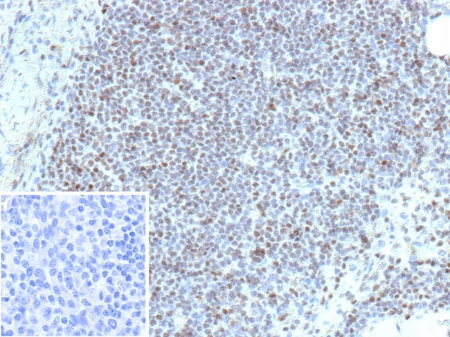 ETS1 (Marker of Tumor Metastasis) Antibody in Immunohistochemistry (Paraffin) (IHC (P))