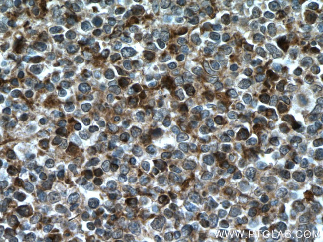 Ceruloplasmin Antibody in Immunohistochemistry (Paraffin) (IHC (P))