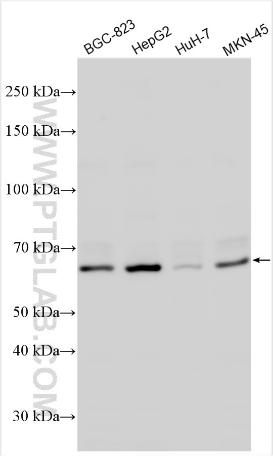 GALNT1 Antibody in Western Blot (WB)