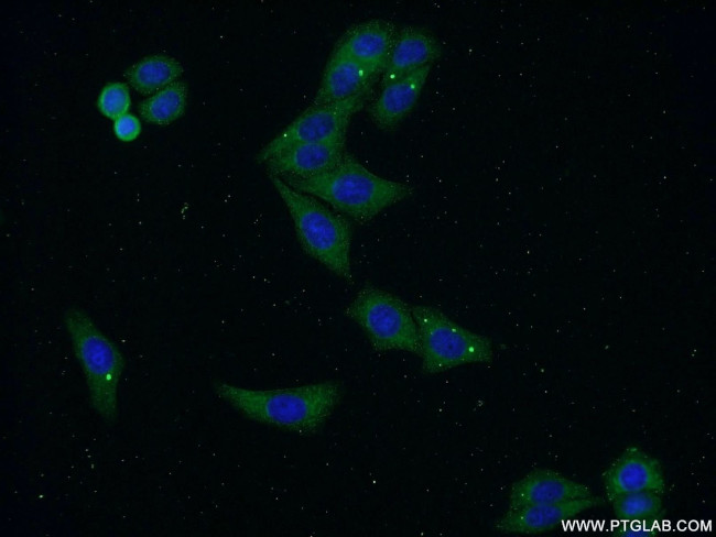 C22orf46 Antibody in Immunocytochemistry (ICC/IF)