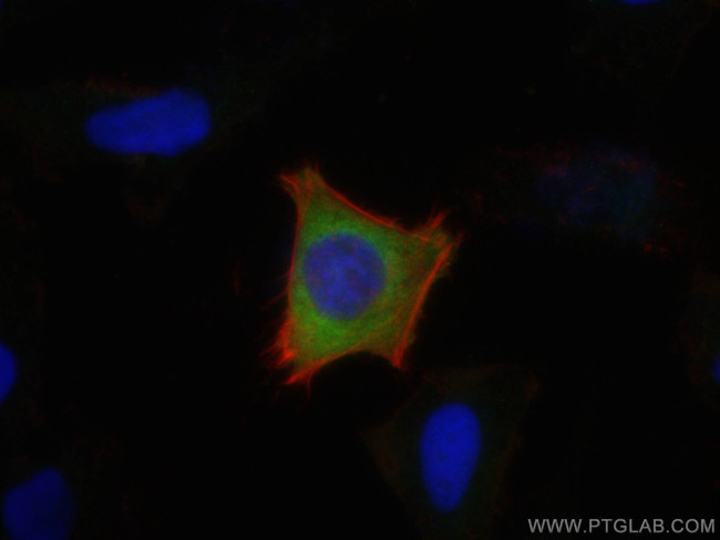 LARS Antibody in Immunocytochemistry (ICC/IF)