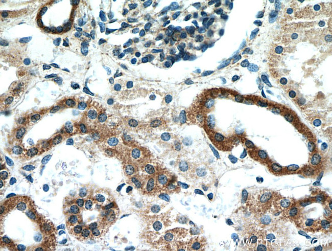TACO1/CCDC44 Antibody in Immunohistochemistry (Paraffin) (IHC (P))