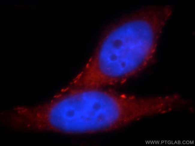 SLITRK6 Antibody in Immunocytochemistry (ICC/IF)