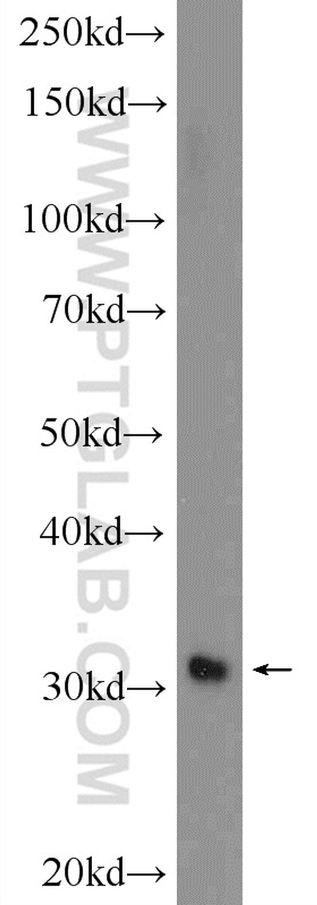GIYD2 Antibody in Western Blot (WB)