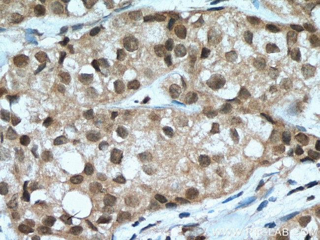 TOX2 Antibody in Immunohistochemistry (Paraffin) (IHC (P))